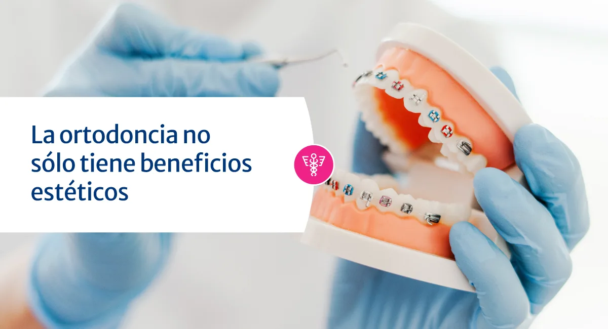 Conoce los beneficios de la ortodoncia